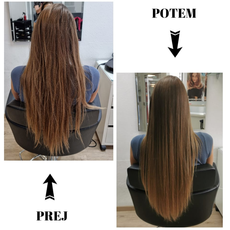 Botoks nega las v Pivki