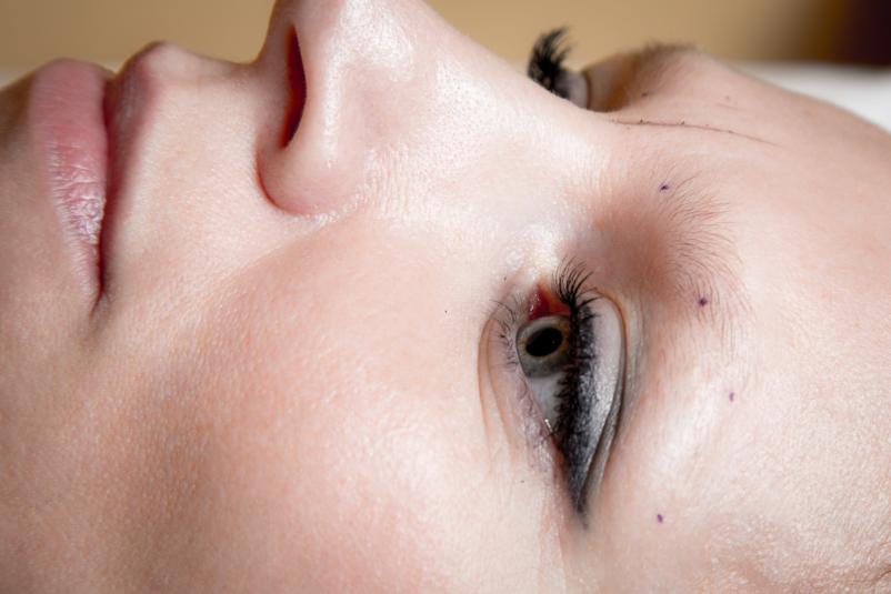 Trepalnice Portorož