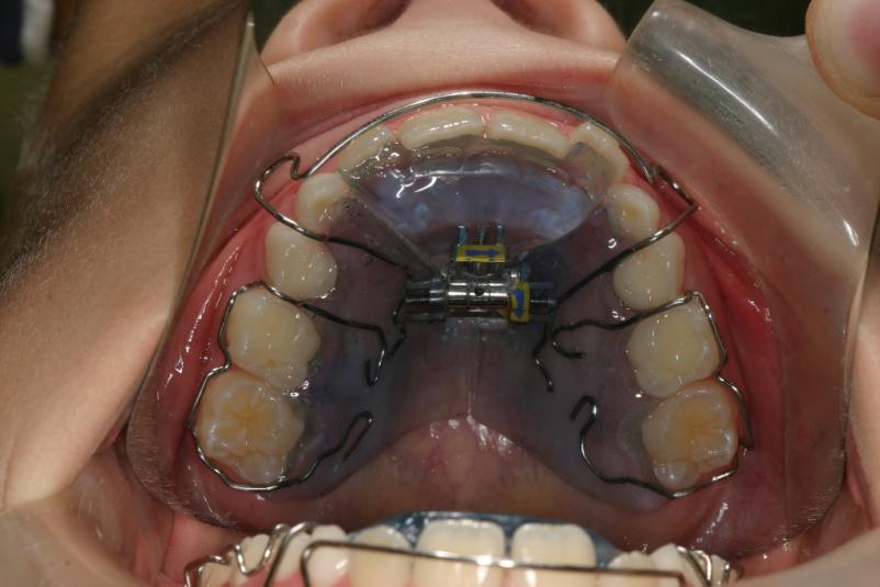 Dober ortodont Murska Sobota