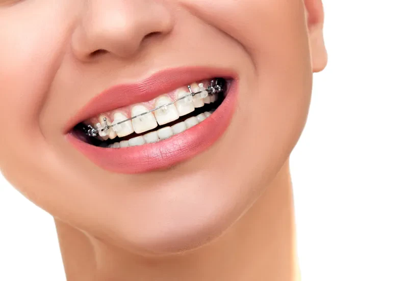 Ortodont Trzin