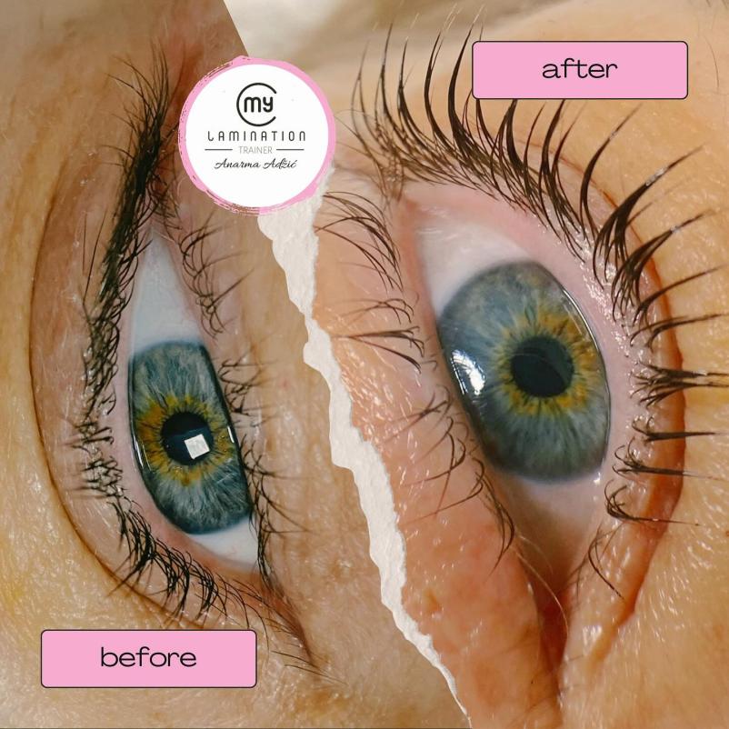 Mikropigmentacija obraza