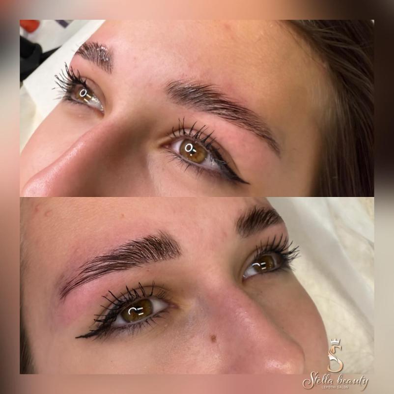 Podaljšanje trepalnic