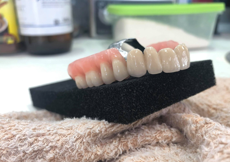 Zobna protetika Polhov Gradec