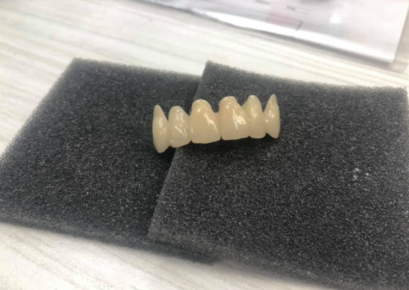 Ugodna zobna protetika Polhov Gradec