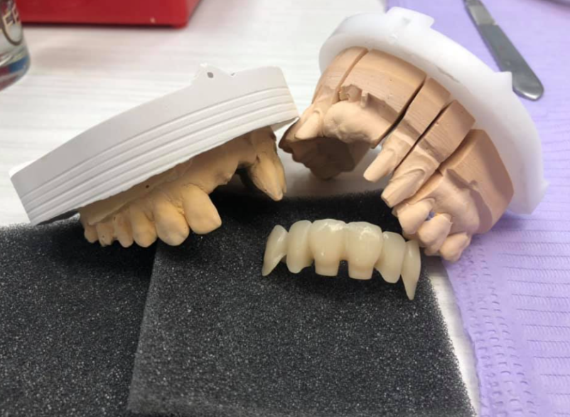 Izdelava zobne proteze Polhov Gradec