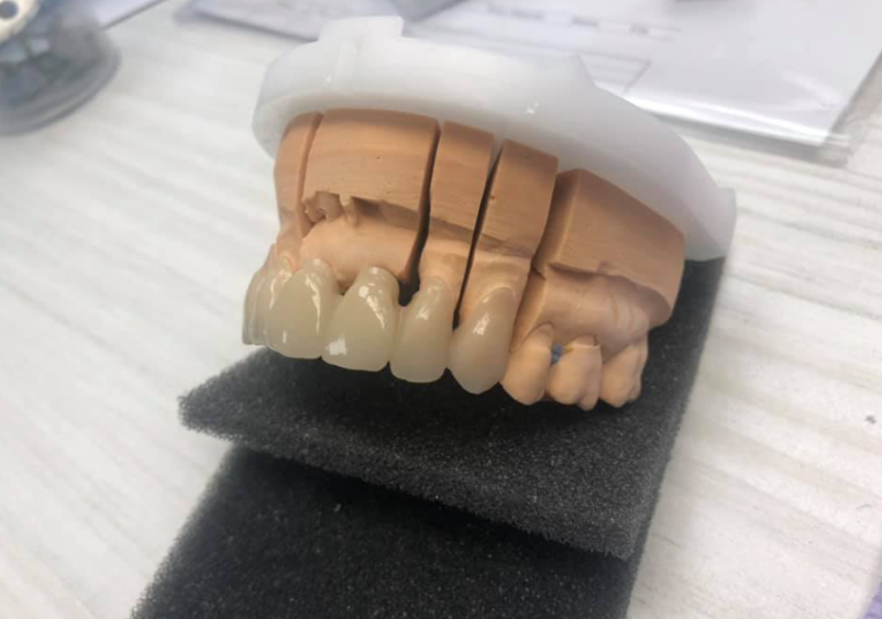 Zobni protetik Polhov Gradec