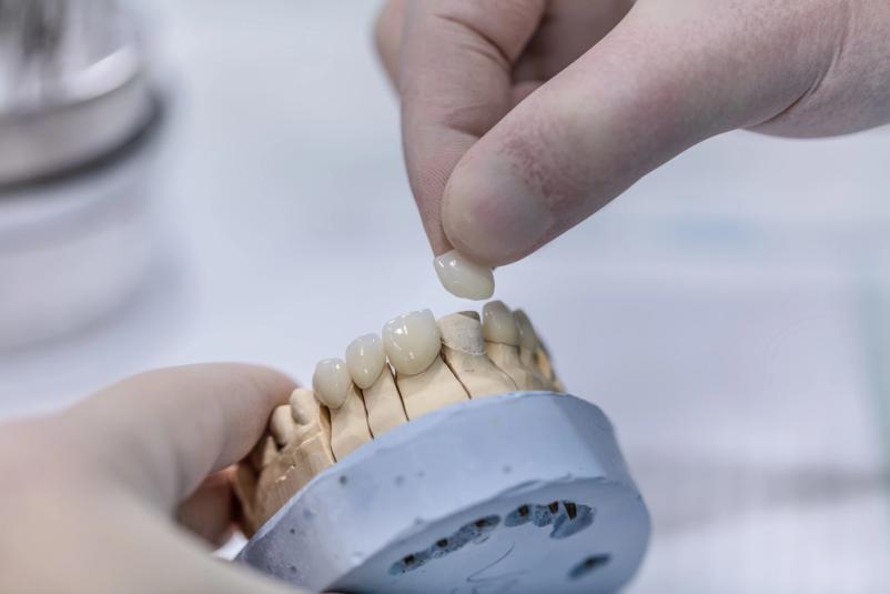 Iščete strokovnjaka, ki je specializiran na zobne implantate v Sežani?