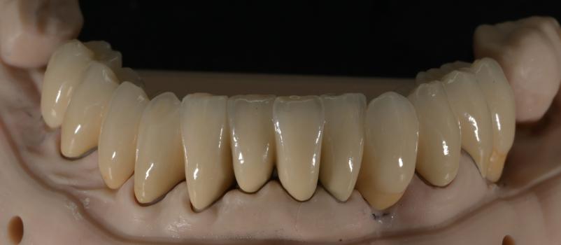 Laboratorij za izdelavo zobnih protetik Šiška