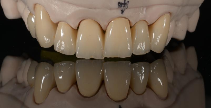 Zobna tehnika in protetika