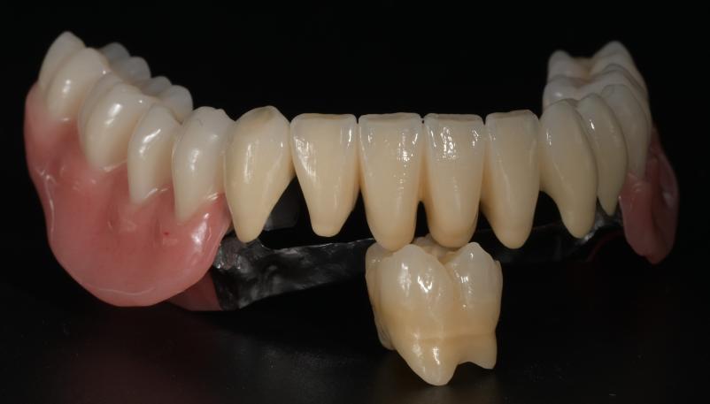 Zobotehnični laboratorij za zobno protetiko Ljubljana