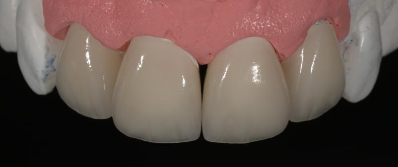 Zobni laboratorij Ljubljana