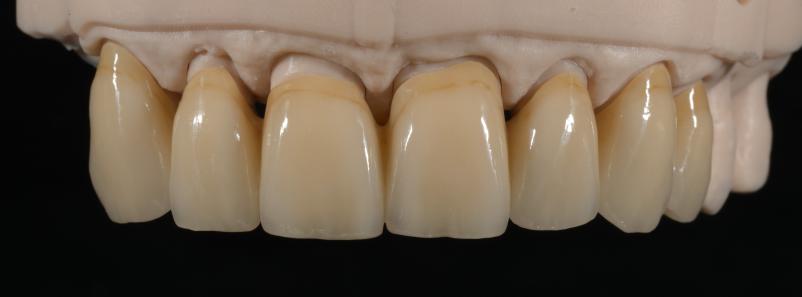 Zobna protetika Ljubljana