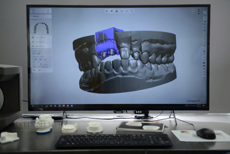 Estetski zobotehnik Ljubljana