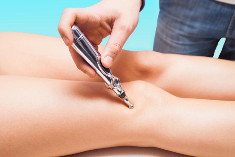 Zdravljenje z lasersko akupunkturo Domžale