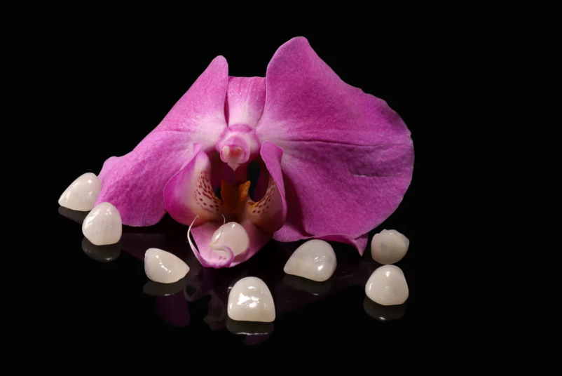 Estetski zobni venirji