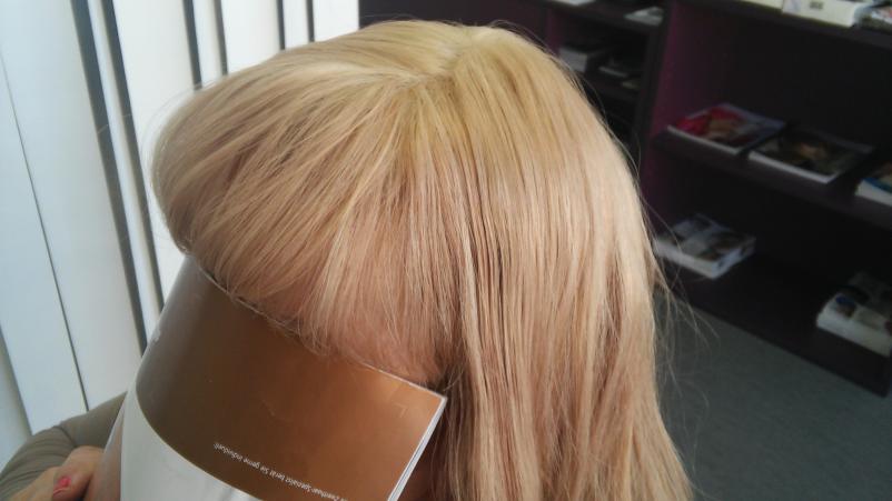 Lasni vložki in proteze Primorska