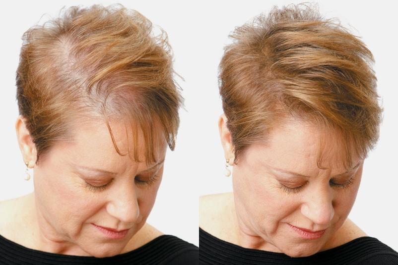 Kvalitetne kranialne proteze Primorska, Slovenija