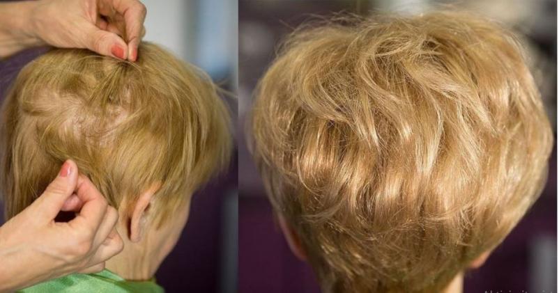 Lasni nadomestki in vsadki Primorska