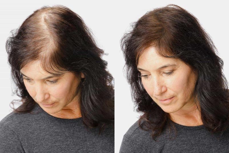 Kvalitetni sistemi integracije las Primorska, Slovenija