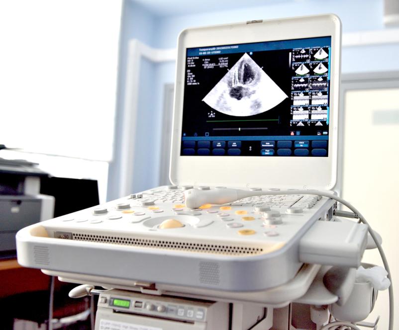 Pregled srca z ultrazvokom