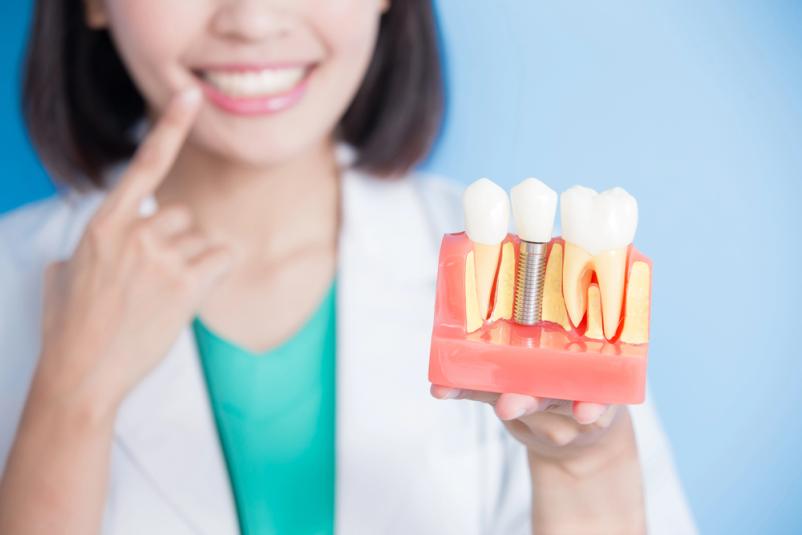 Kvalitetni 3D tisk dentalnih konstrukcij