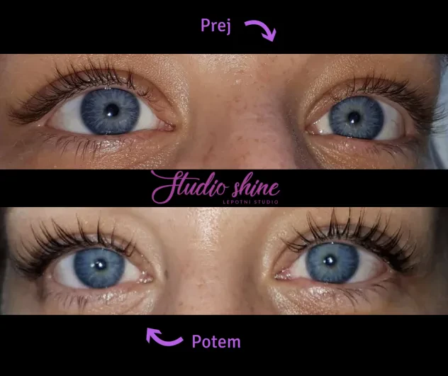 Lash lift terapija Ljubljana