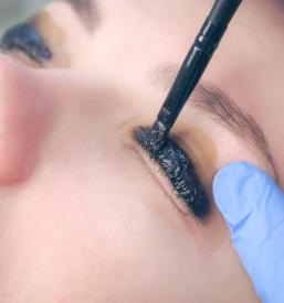 laminacija trepalnic