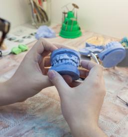 Izdelava zobne protetike