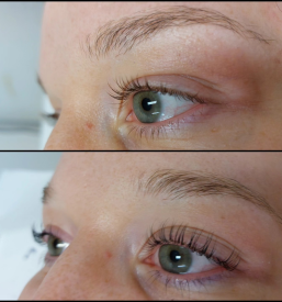 Trepalnice keratin Ljubljana