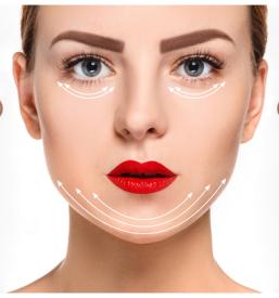 Nekirurški lifting obraza