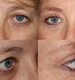 Lepotna kirurgija Domžale