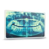 Zasebna zobna ordinacija Emilija Živković dr. dent. med.