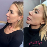 Perfect Lips Beauty Center