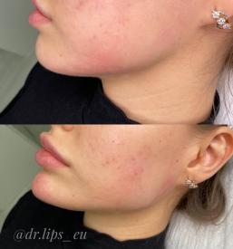 polne ustnice Primorska