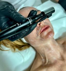 Nega obraza Murska Sobota