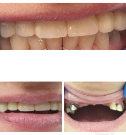 Poskrbimo za lep nasmeh