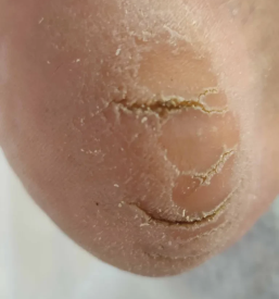 Ugodna pedikura na domu Maribor