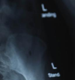 Magnetna resonanca Slovenija