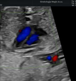 Dobra samoplačniška ginekološka ambulanta Ljubljana, Bežigrad