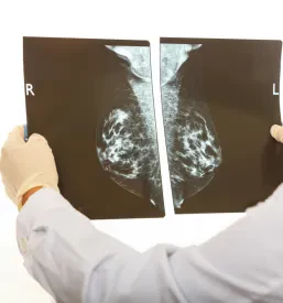 Pregled in ultrazvok dojk Gorica