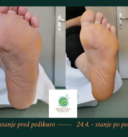 Refleksna masaža stopal na domu