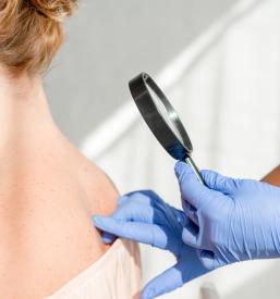 Pregledi kože Obala