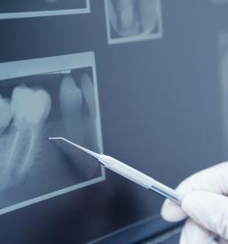 Analiza rentgenske slike zob