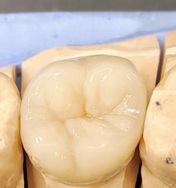 Zobotehnične storitve