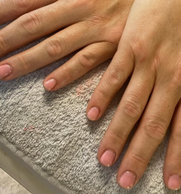 Podaljševanje nohtov