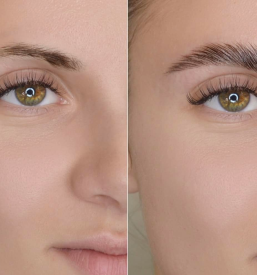 Urejanje trepalnic Koper