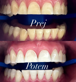 Zobozdravnik Štajerska