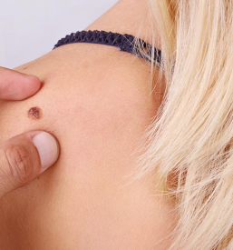 Dermatologija v Celju