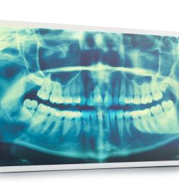 zasebna zobozdravnica Ljubljana Šiška