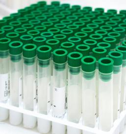 Hiter Urea dihalni test v Rogaški